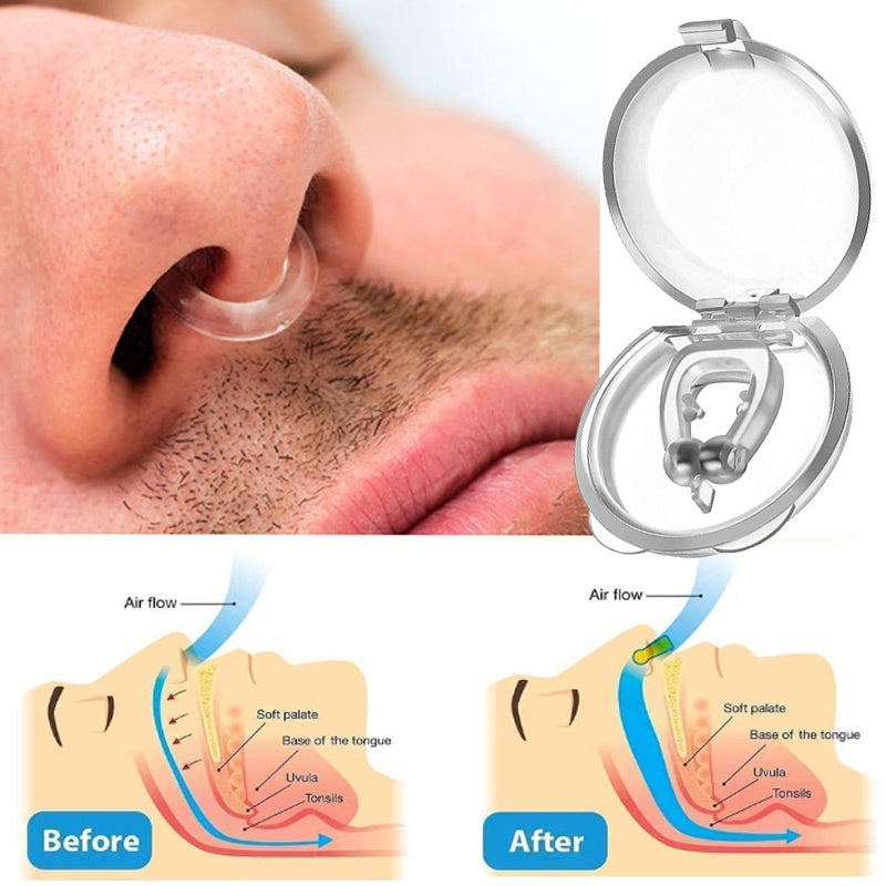 Dispositivo Nasal Anti Ronquido