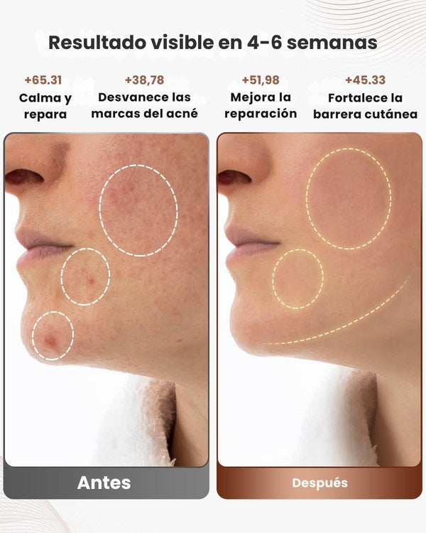 Máscara LED Belleza Radiante