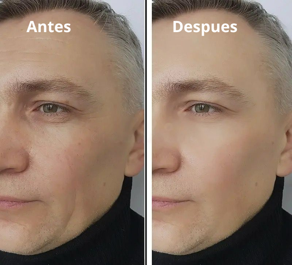 2X1 Crema Facial Hombre EELHOE