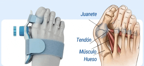 JuanetFlex Corrector Avanzado de Juanetes