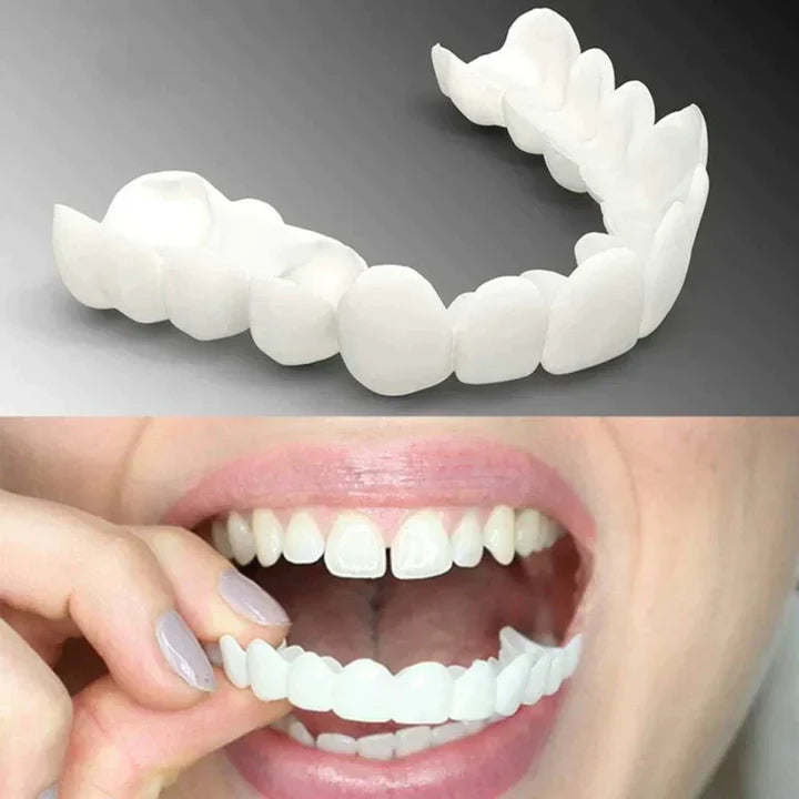 Sonrisa Ideal: Carillas Snap On