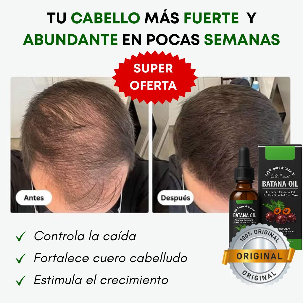 Aceite Natural para Cabello Saludable  - PROMOCIÓN 2X1