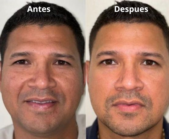 2X1 Crema Facial Hombre EELHOE
